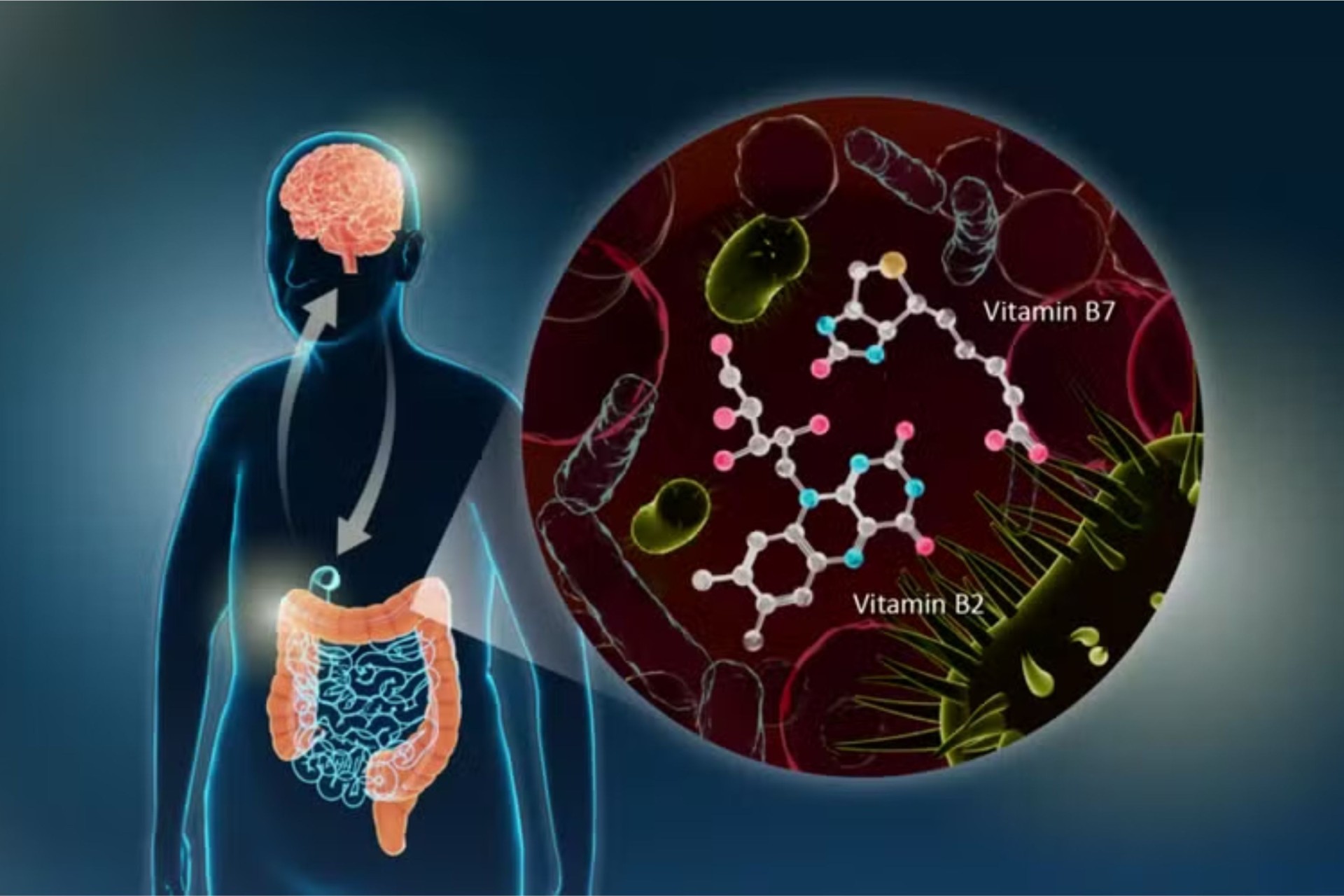 Parkinson: cientistas japoneses descobrem ligação da doença com bactérias do intestino; entenda